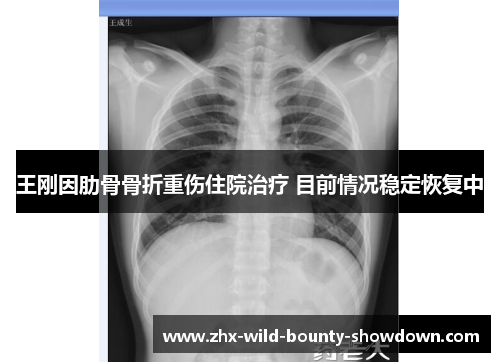 王刚因肋骨骨折重伤住院治疗 目前情况稳定恢复中 王刚因肋骨骨折重伤住院治疗 目前情况稳定恢复中